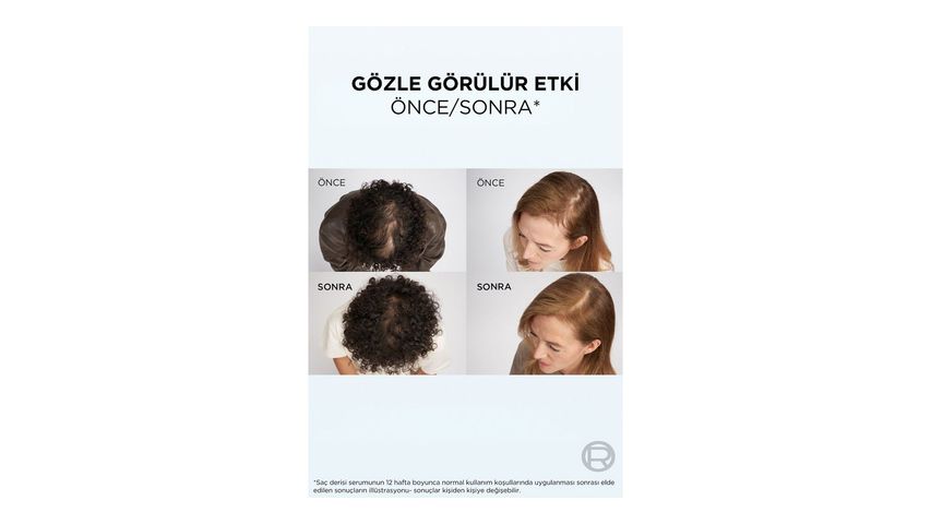 Elseve Growth Booster Dökülme Karşıtı Saç Bakım Serumu 102 ml